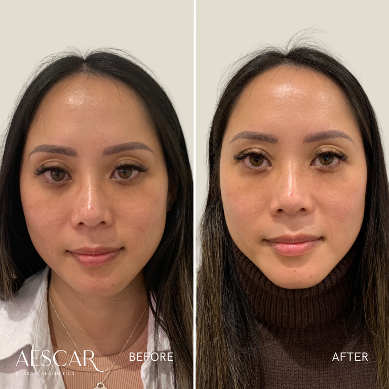 Rejuran b&a.zip - 10