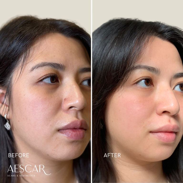 Rejuran b&a.zip - 13