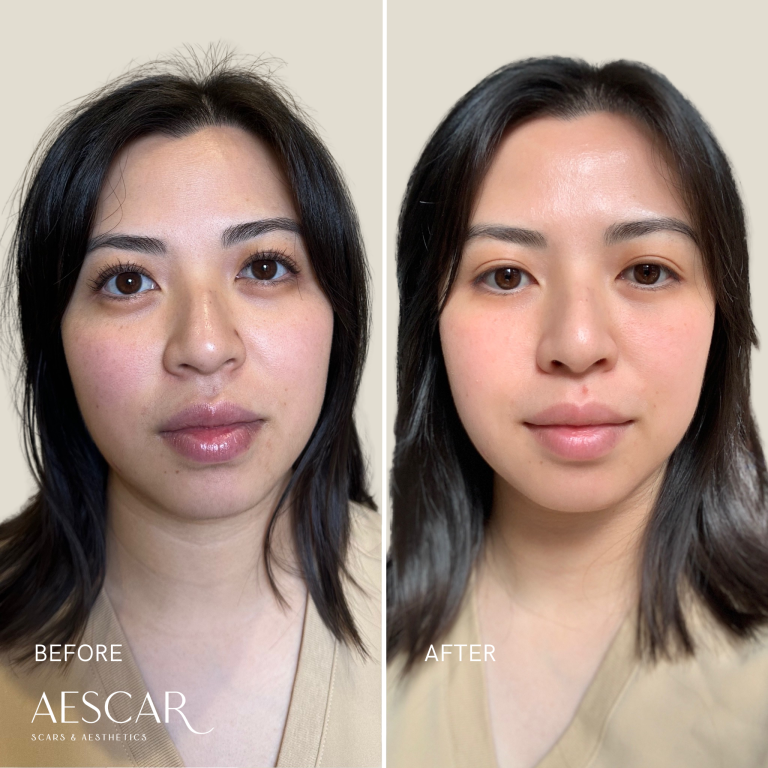 Rejuran b&a.zip - 14