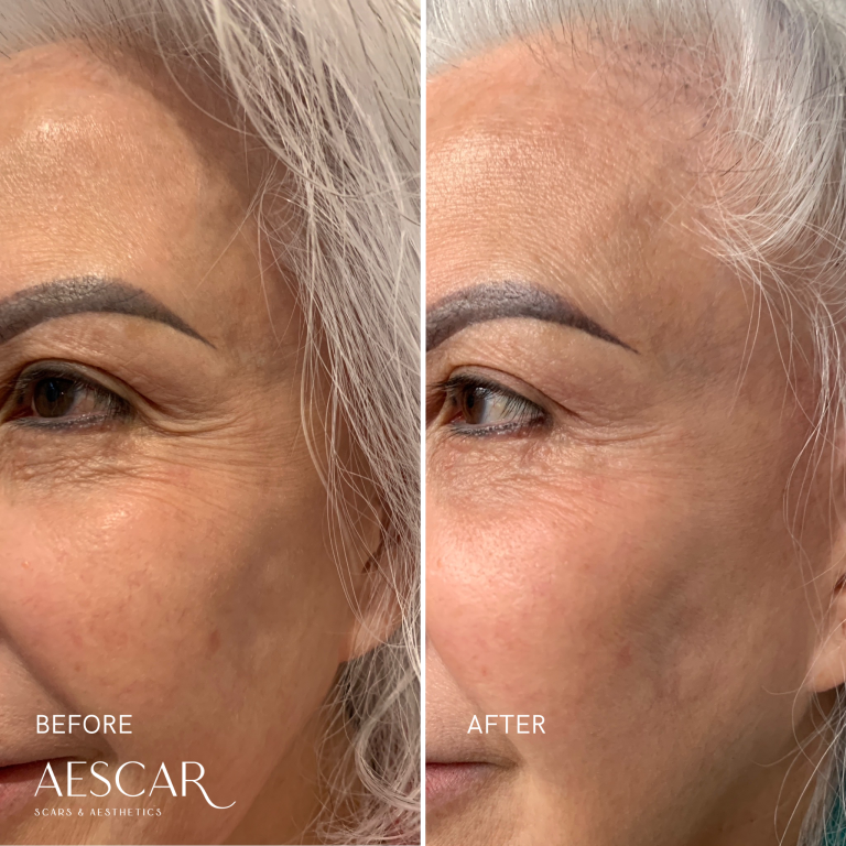Rejuran b&a.zip - 17