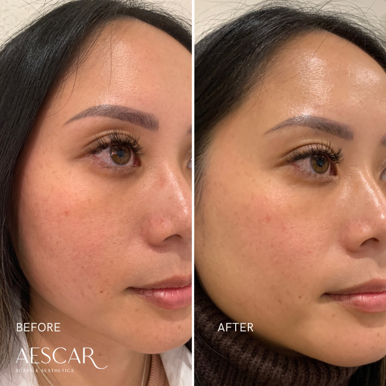 Rejuran b&a.zip - 8
